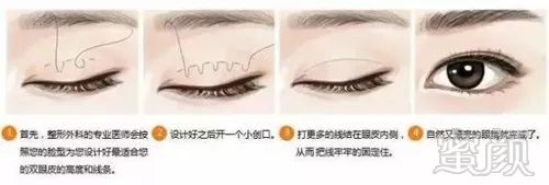 https://img.miyanlife.com/mnt/timg/180209/1300551249-1.jpg