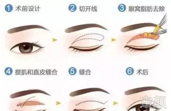 https://img.miyanlife.com/mnt/timg/180209/1300555962-3.jpg