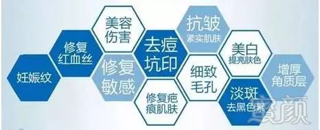 https://img.miyanlife.com/mnt/timg/180209/1302554535-1.jpg