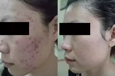 https://img.miyanlife.com/mnt/timg/180209/130255F25-2.jpg