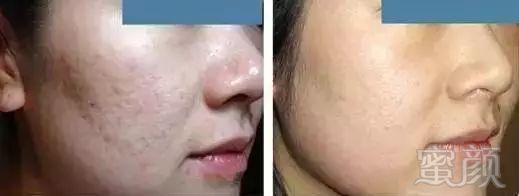 https://img.miyanlife.com/mnt/timg/180209/1302561O5-7.jpg