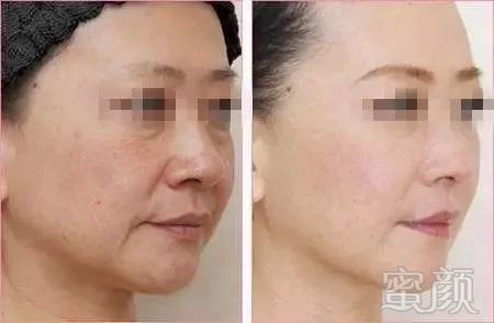 https://img.miyanlife.com/mnt/timg/180209/1302564336-8.jpg