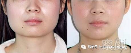 https://img.miyanlife.com/mnt/timg/180209/13095K522-2.jpg