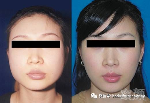 https://img.miyanlife.com/mnt/timg/180209/13095Q100-10.jpg