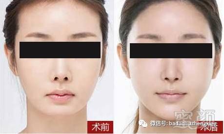 https://img.miyanlife.com/mnt/timg/180209/13095Q146-8.jpg