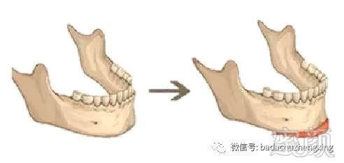 https://img.miyanlife.com/mnt/timg/180209/13095S139-6.jpg