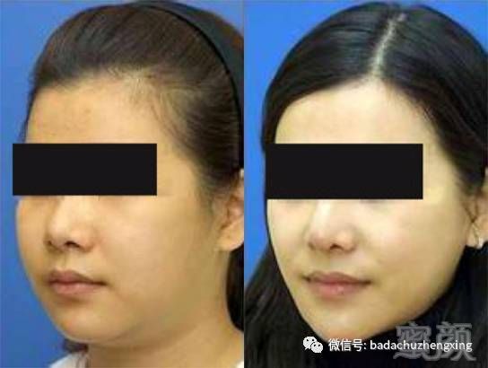 https://img.miyanlife.com/mnt/timg/180209/13095aM9-12.jpg
