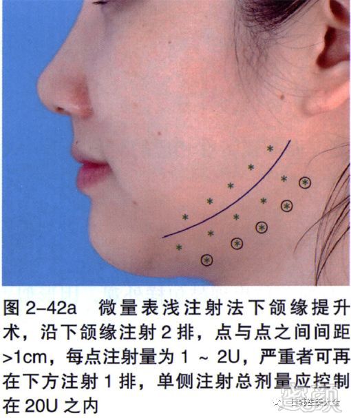 案例图片