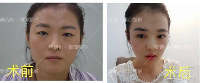 https://img.miyanlife.com/mnt/timg/180209/1350095147-10.jpg