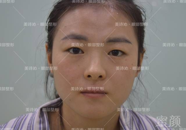 https://img.miyanlife.com/mnt/timg/180209/13500JB9-2.jpg