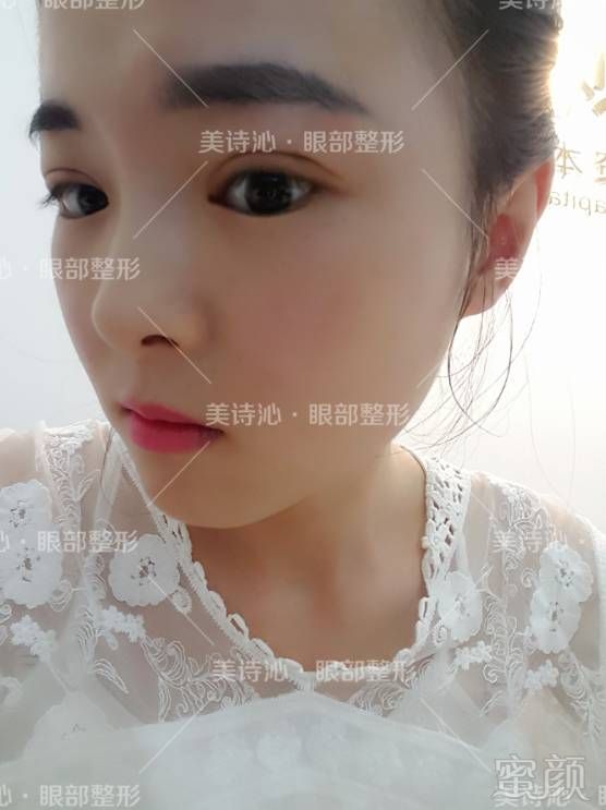 https://img.miyanlife.com/mnt/timg/180209/13500Q252-9.jpg