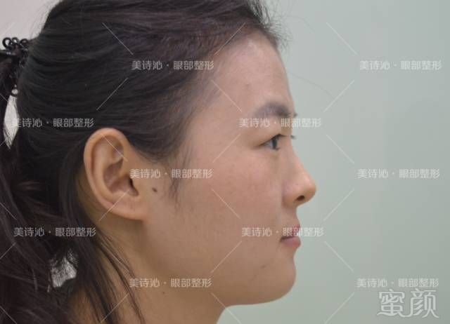 https://img.miyanlife.com/mnt/timg/180209/13500W261-5.jpg