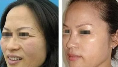 https://img.miyanlife.com/mnt/timg/180210/104U12S8-9.jpg