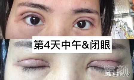 https://img.miyanlife.com/mnt/timg/180210/1102451V1-2.jpg