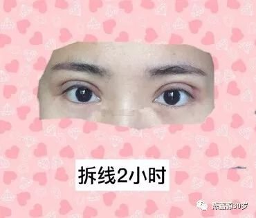 https://img.miyanlife.com/mnt/timg/180210/1102462264-4.jpg