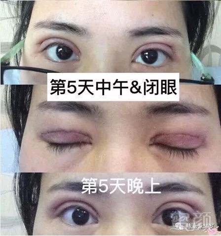 https://img.miyanlife.com/mnt/timg/180210/11024640D-3.jpg