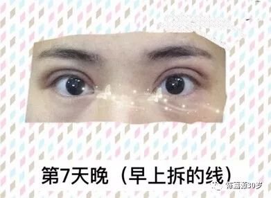 https://img.miyanlife.com/mnt/timg/180210/11024BB6-5.jpg