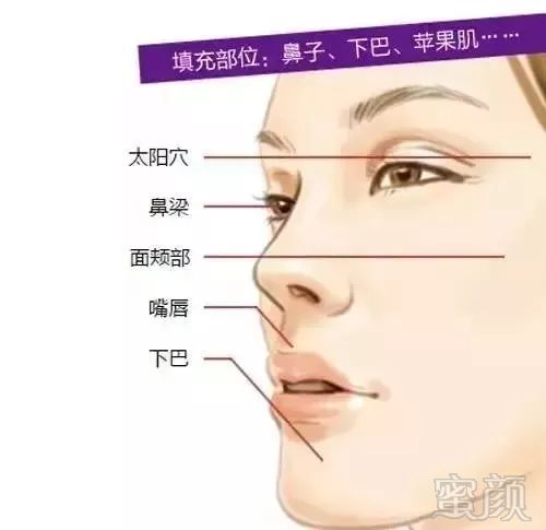 https://img.miyanlife.com/mnt/timg/180210/111AT519-2.jpg