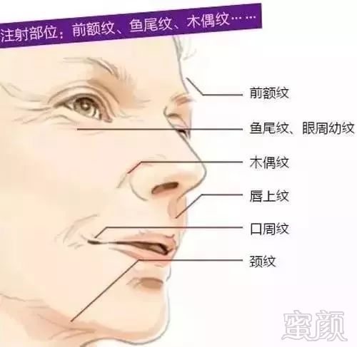 https://img.miyanlife.com/mnt/timg/180210/111AVU2-0.jpg