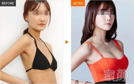 https://img.miyanlife.com/mnt/timg/180210/11321RP4-10.jpg