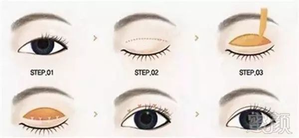 https://img.miyanlife.com/mnt/timg/180210/113F43117-6.jpg