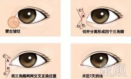 https://img.miyanlife.com/mnt/timg/180210/113F45V7-7.jpg