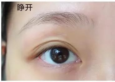 https://img.miyanlife.com/mnt/timg/180210/1154591407-4.jpg