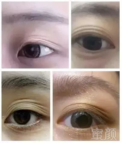 https://img.miyanlife.com/mnt/timg/180210/11545S149-1.jpg