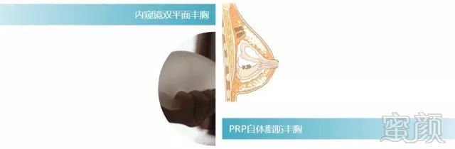 https://img.miyanlife.com/mnt/timg/180210/12135I601-2.jpg