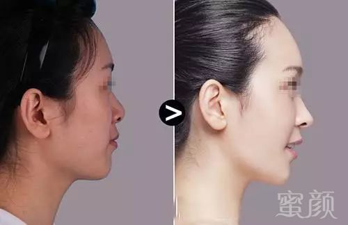https://img.miyanlife.com/mnt/timg/180211/1333292330-4.jpg