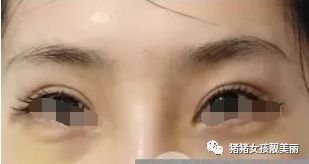 https://img.miyanlife.com/mnt/timg/180211/13344B0L-8.jpg
