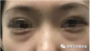 https://img.miyanlife.com/mnt/timg/180211/13344B0a-7.jpg