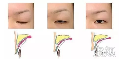 https://img.miyanlife.com/mnt/timg/180211/134I01U4-3.jpg