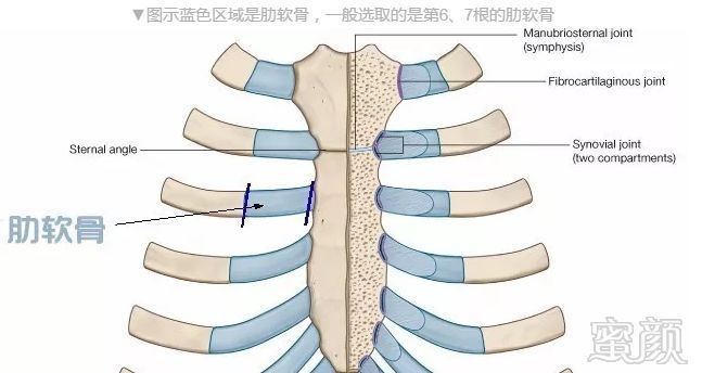 案例图片