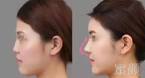https://img.miyanlife.com/mnt/timg/180212/121125JG-4.jpg