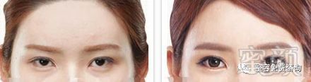 https://img.miyanlife.com/mnt/timg/180212/12514HK8-3.jpg