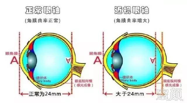 https://img.miyanlife.com/mnt/timg/180212/1255063950-0.jpg
