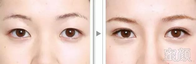 https://img.miyanlife.com/mnt/timg/180212/1255063C3-2.jpg
