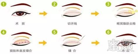 https://img.miyanlife.com/mnt/timg/180212/12550A507-1.jpg
