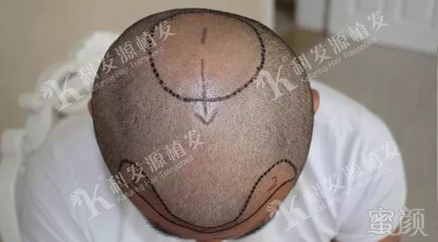 https://img.miyanlife.com/mnt/timg/180212/1256241051-3.jpg