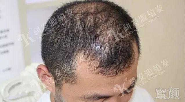 https://img.miyanlife.com/mnt/timg/180212/12562442V-1.jpg