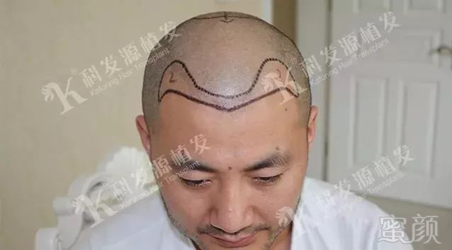 https://img.miyanlife.com/mnt/timg/180212/125624J28-2.jpg
