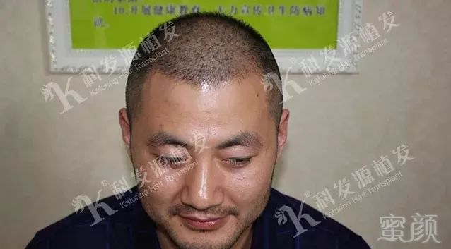 https://img.miyanlife.com/mnt/timg/180212/12562B235-9.jpg