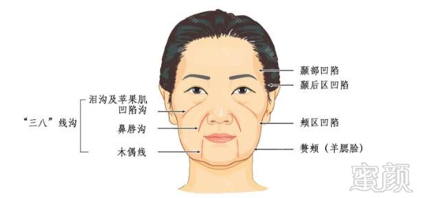 https://img.miyanlife.com/mnt/timg/180212/1314092P6-0.jpg