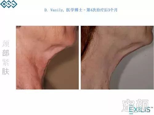 https://img.miyanlife.com/mnt/timg/180212/131411L91-8.jpg