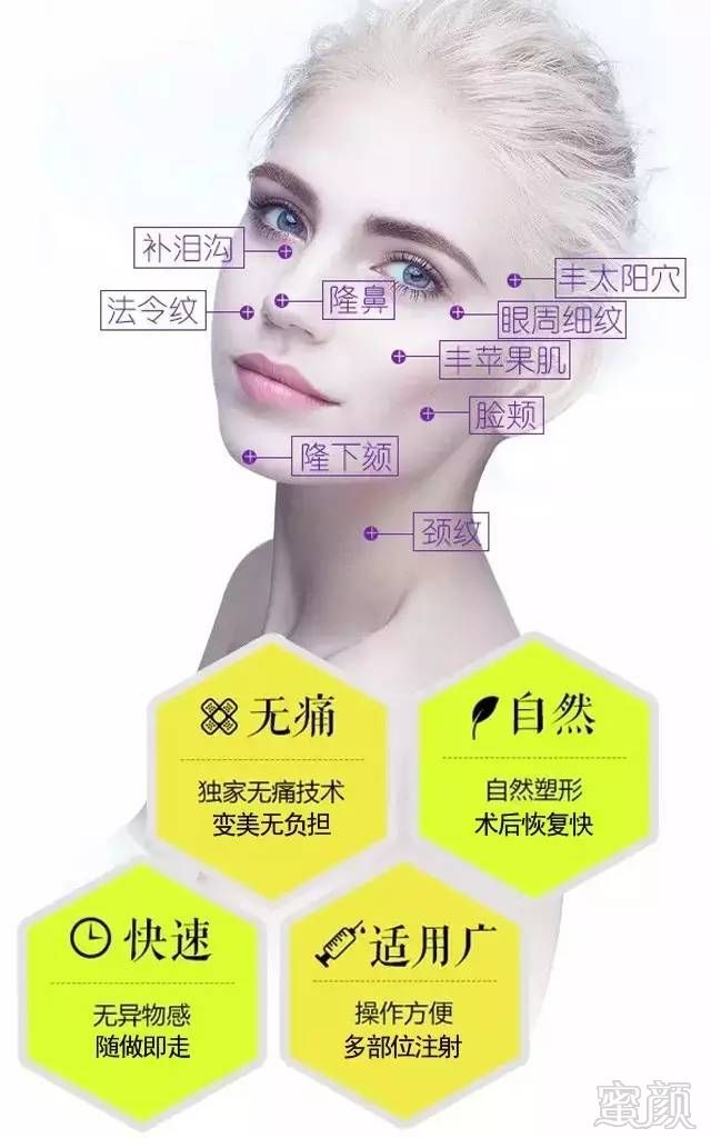 https://img.miyanlife.com/mnt/timg/180212/131A64133-5.jpg