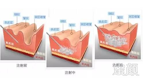 https://img.miyanlife.com/mnt/timg/180212/1329346427-4.jpg