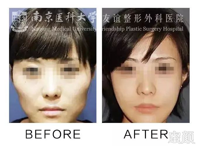 https://img.miyanlife.com/mnt/timg/180212/1329353Z0-7.jpg