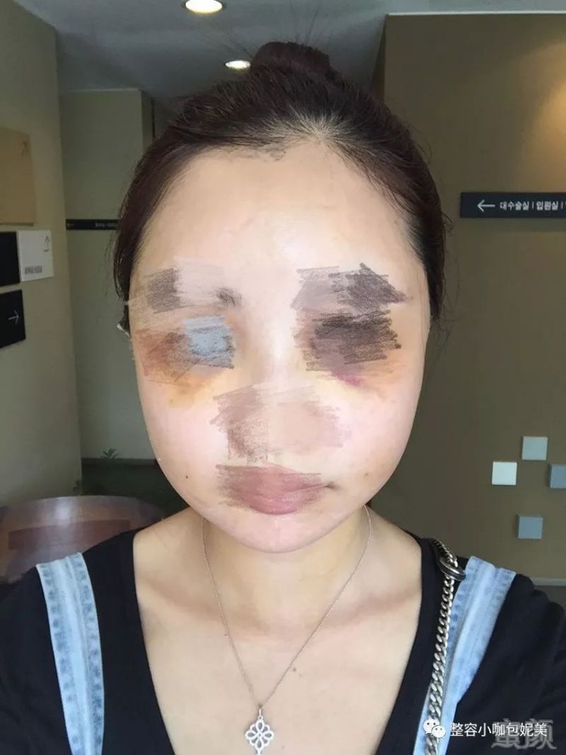 https://img.miyanlife.com/mnt/timg/180212/1355444N3-2.jpg
