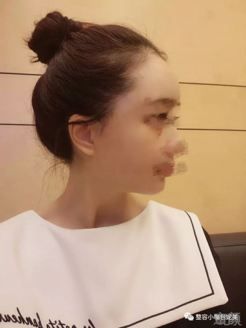 https://img.miyanlife.com/mnt/timg/180212/1355461156-5.jpg